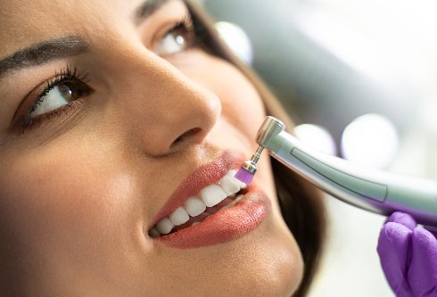 Fluoryzacja kontaktowa polerowanie zębów u kobiety